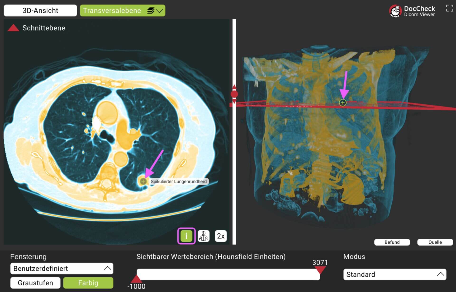 DICOM-Viewer: Annotationen