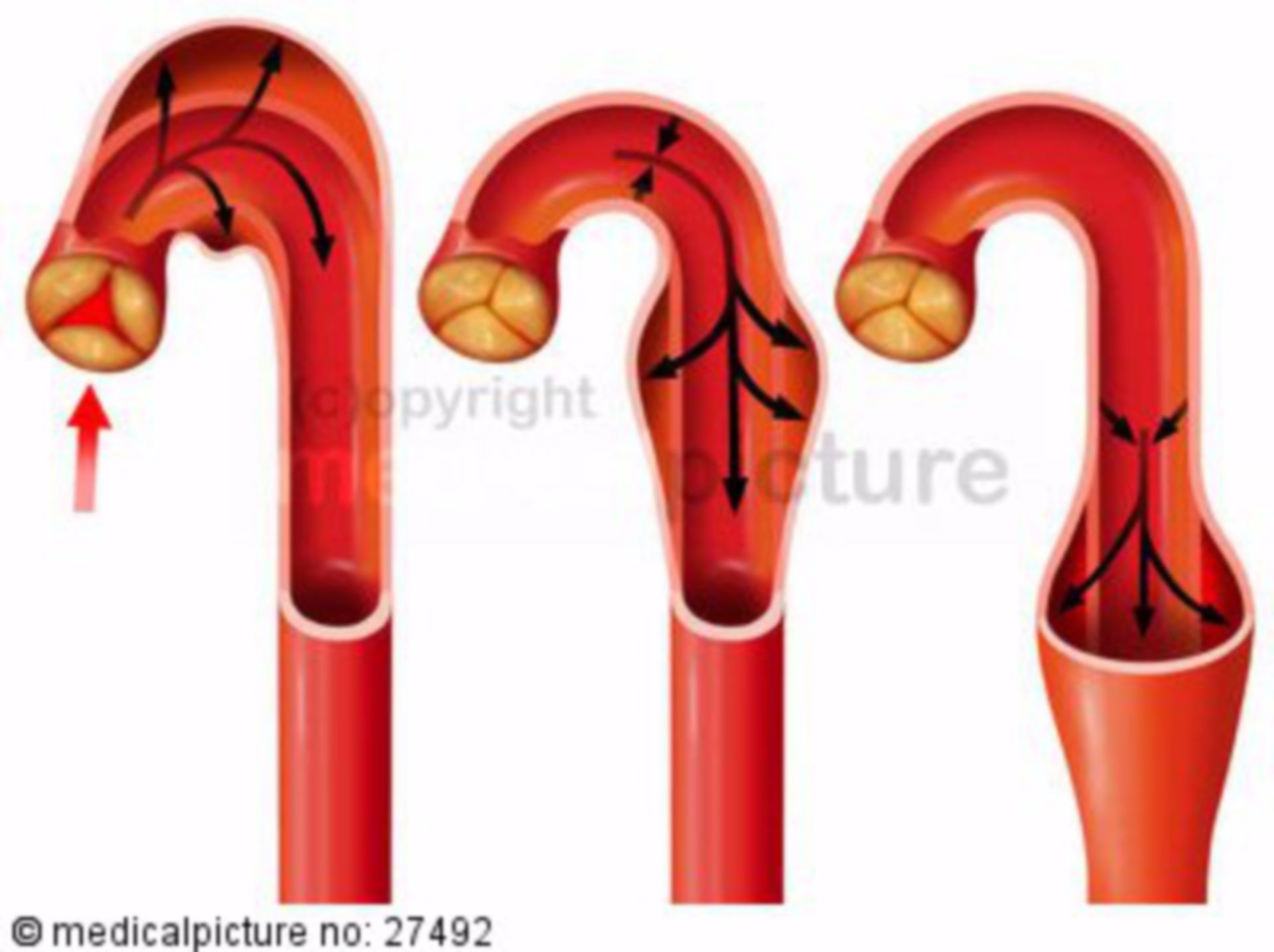 Circulatory sytem, aorta, windkessel effect