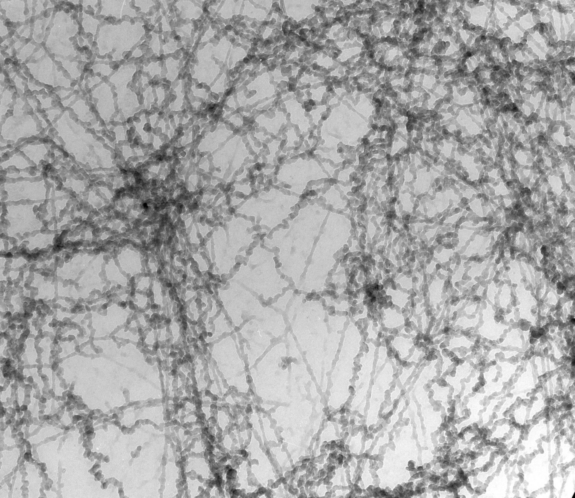 Notopthalmus viridescence (Nuclear chromatin) - CIL:10087