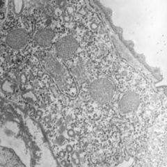 Dictyosom DocCheck Flexikon