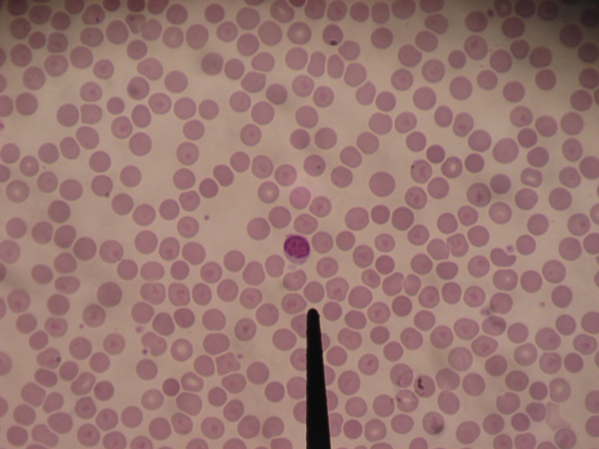 Bovine blood smear 3 - lymphocyte