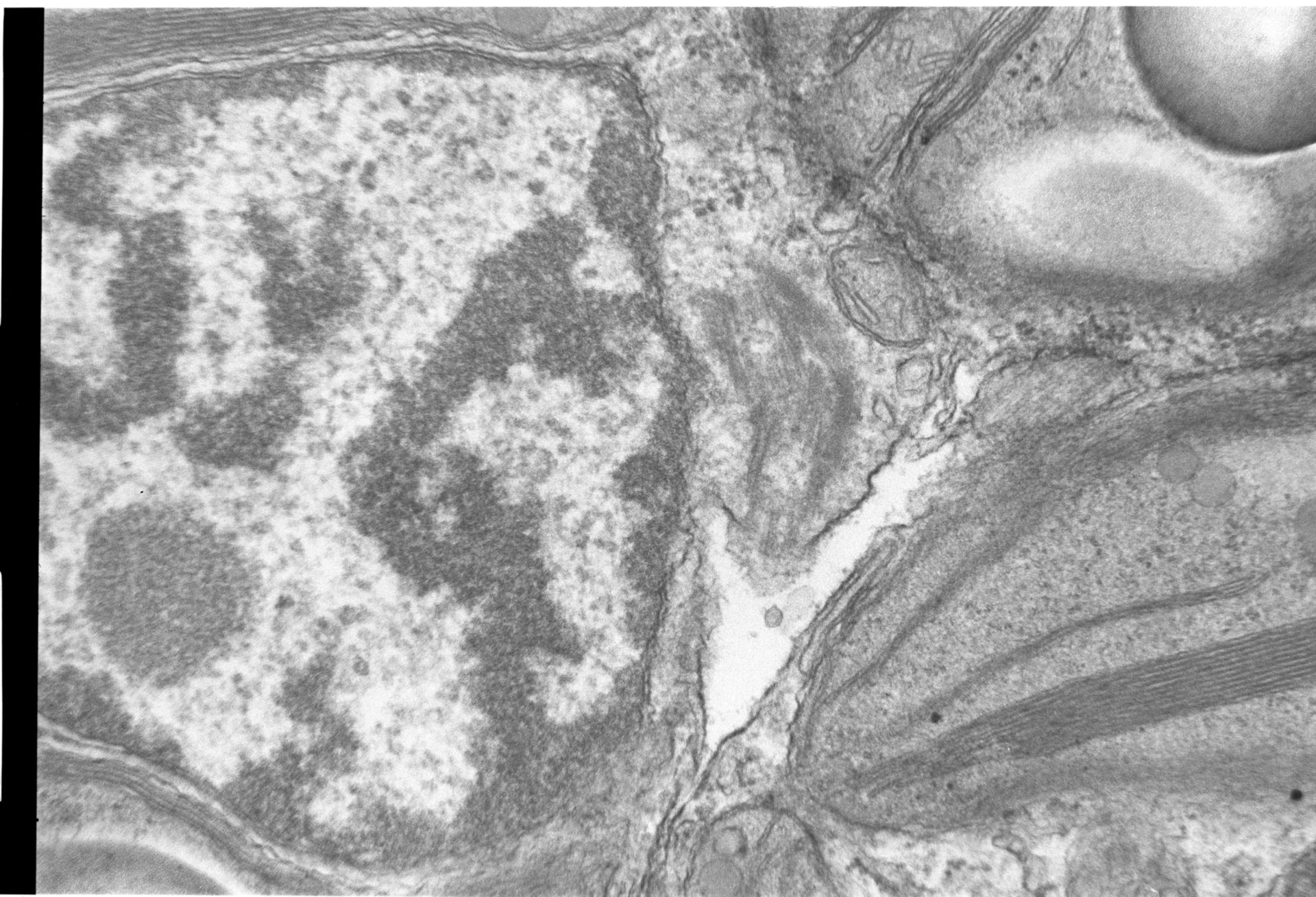 Acetabularia mediterranea (Chloroplast starch grain) - CIL:551