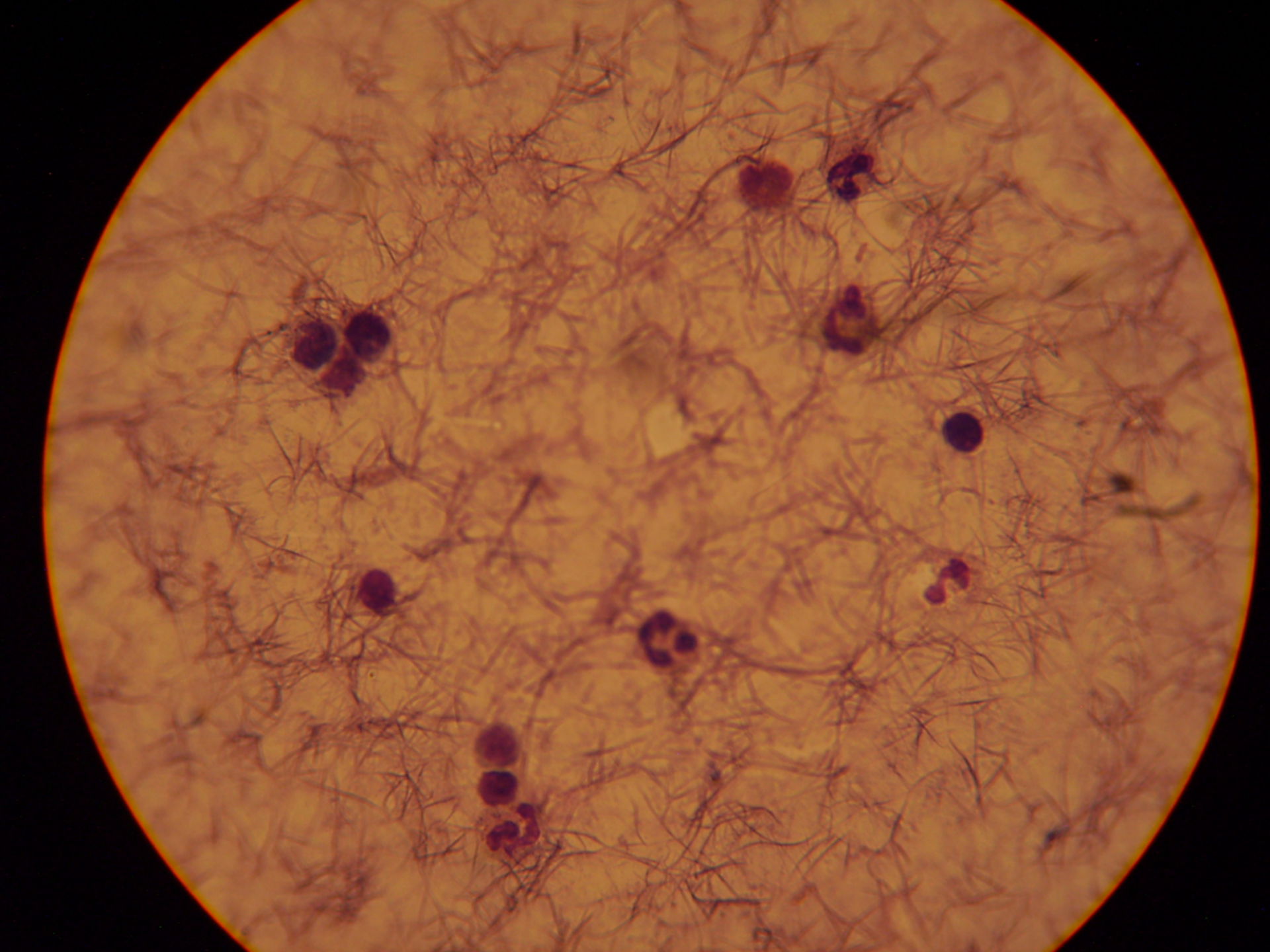 Plasmodium ovale punteggiatura