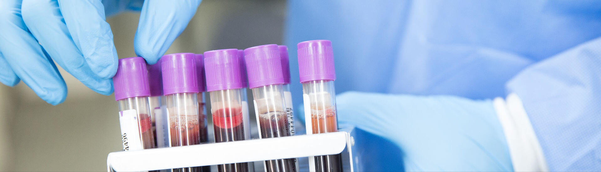 Corona-Antikörpertest auf Kasse - DocCheck