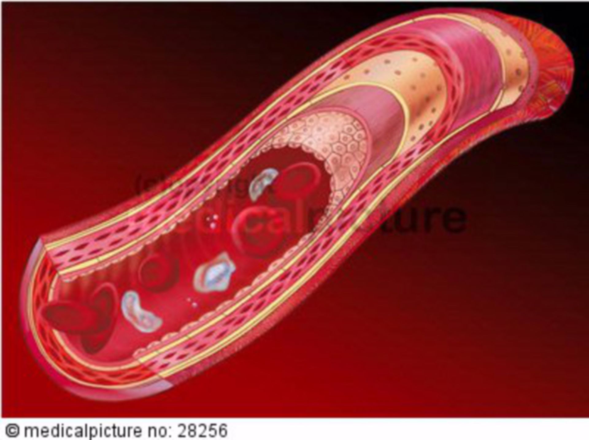  Arterie vom muskulären Typ 
