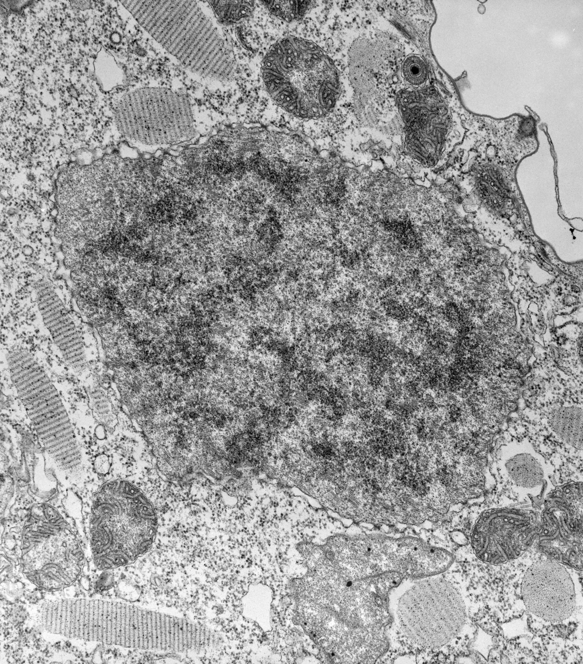 Paramecium caudatum (Nuclear pore) - CIL:39204