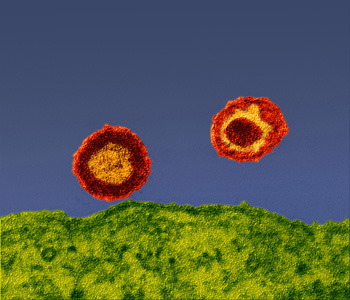 Zwei HI-Viren außerhalb der Zelle (grün). © PEI
