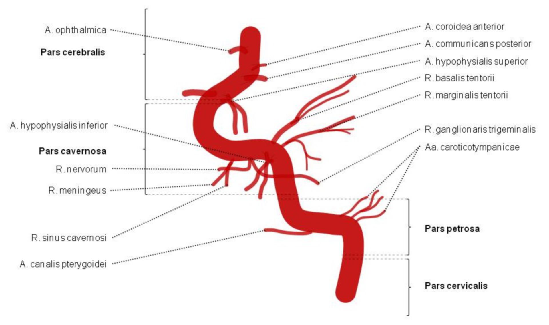 Internal carotid artery - sections and branches