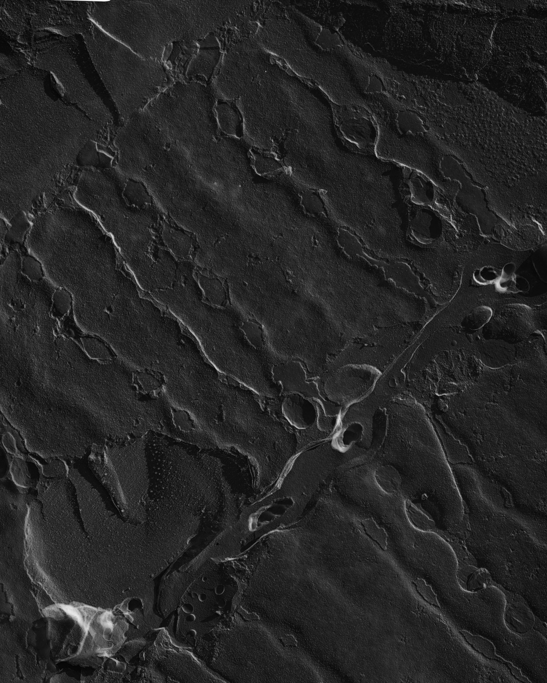 Damselfly (Sarcoplasmic reticulum) - CIL:18479