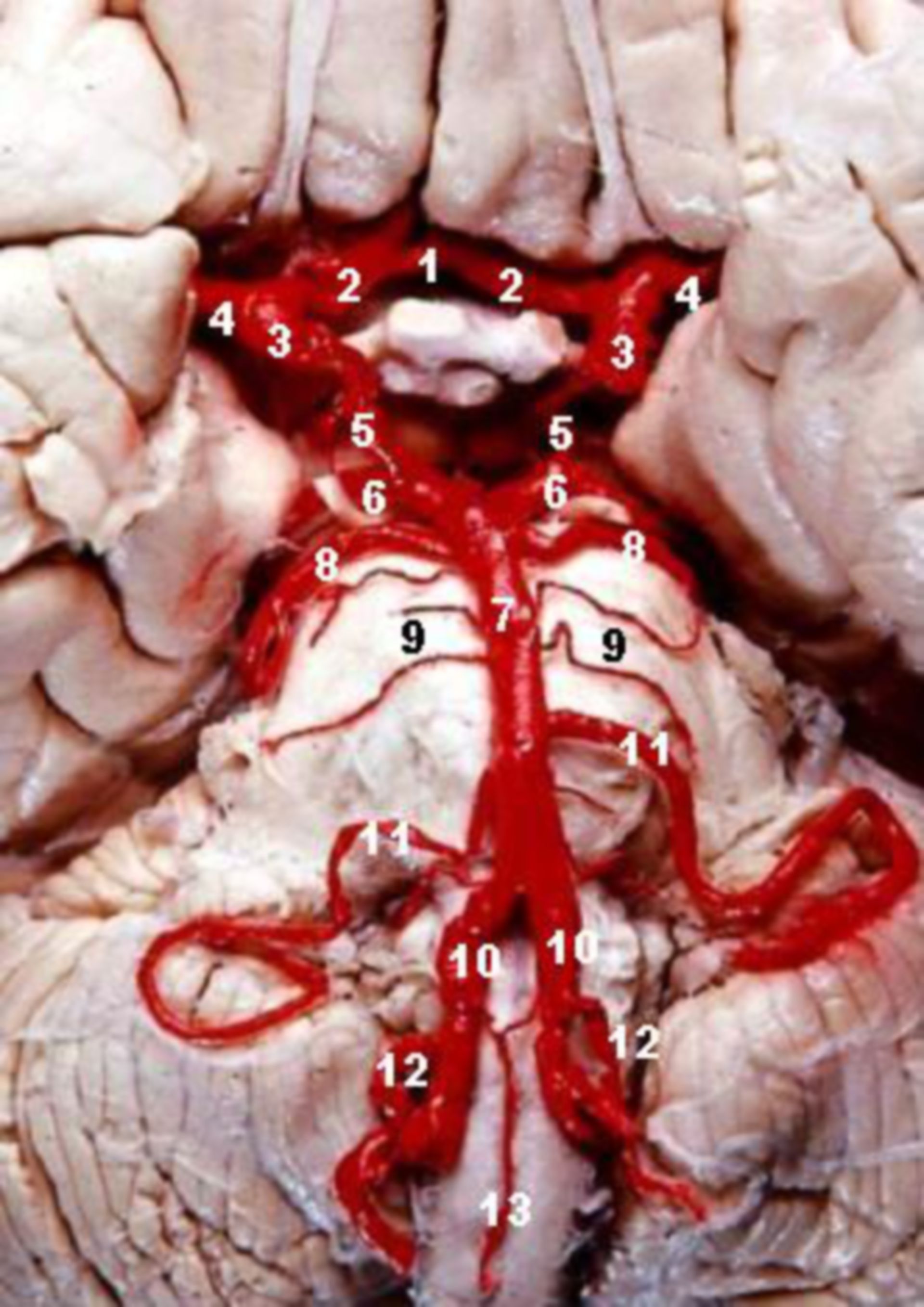 Blood circulation of the brain stem - Circle of Willis