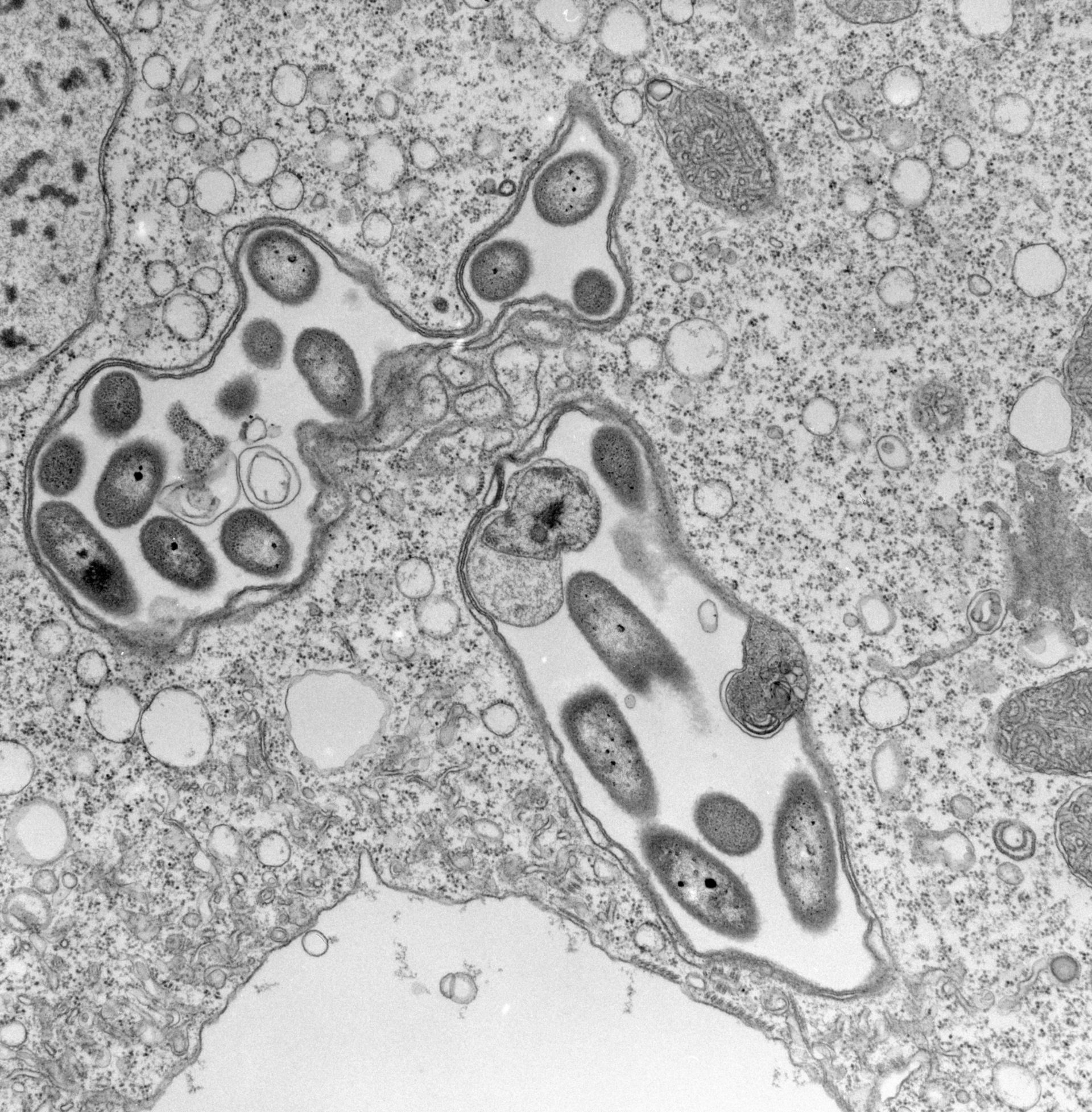 Vorticella convallaria (Microtubule associated complex) - CIL:39504