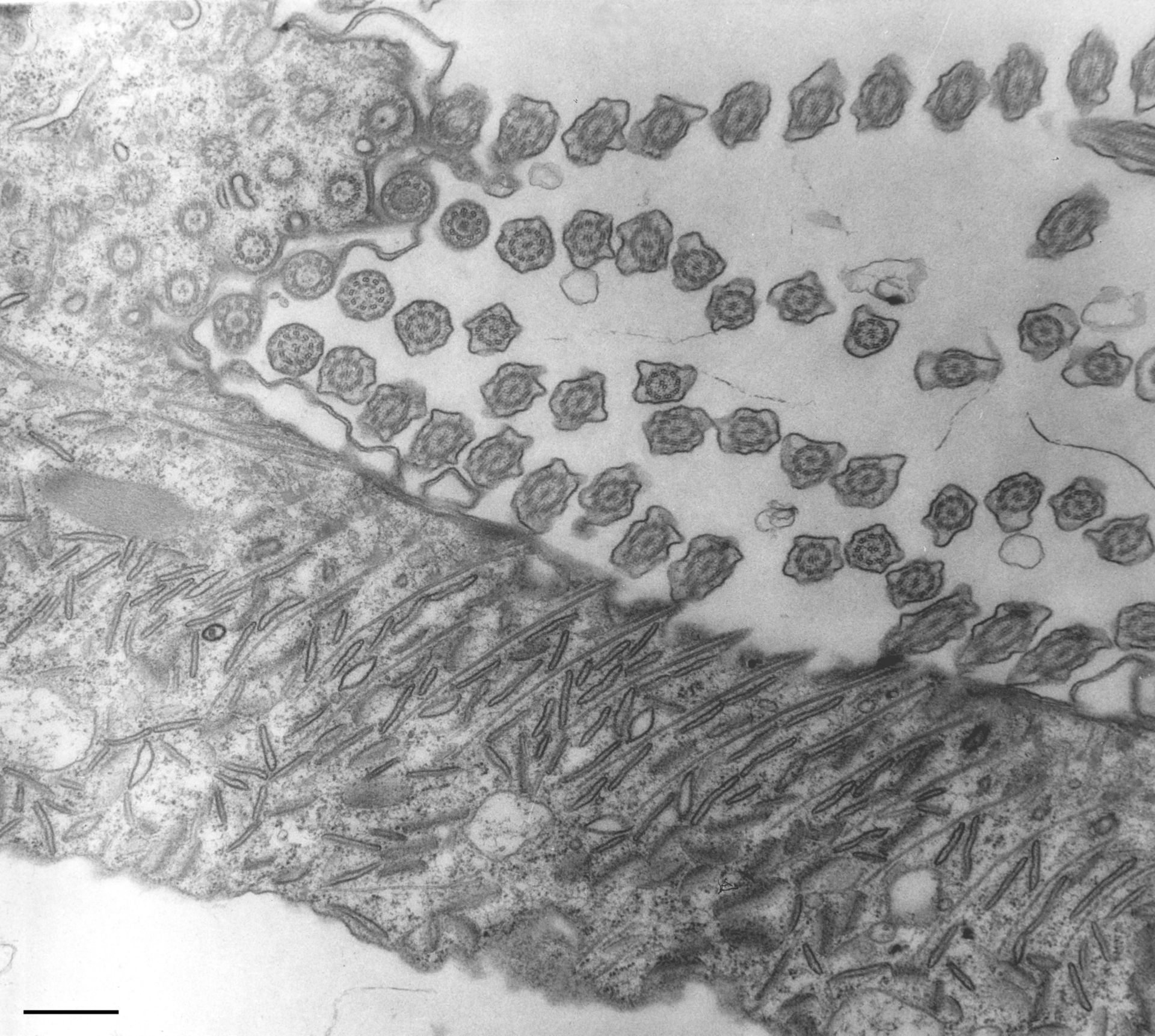Paramecium multimicronucleatum (Microtubule associated complex) - CIL:36703