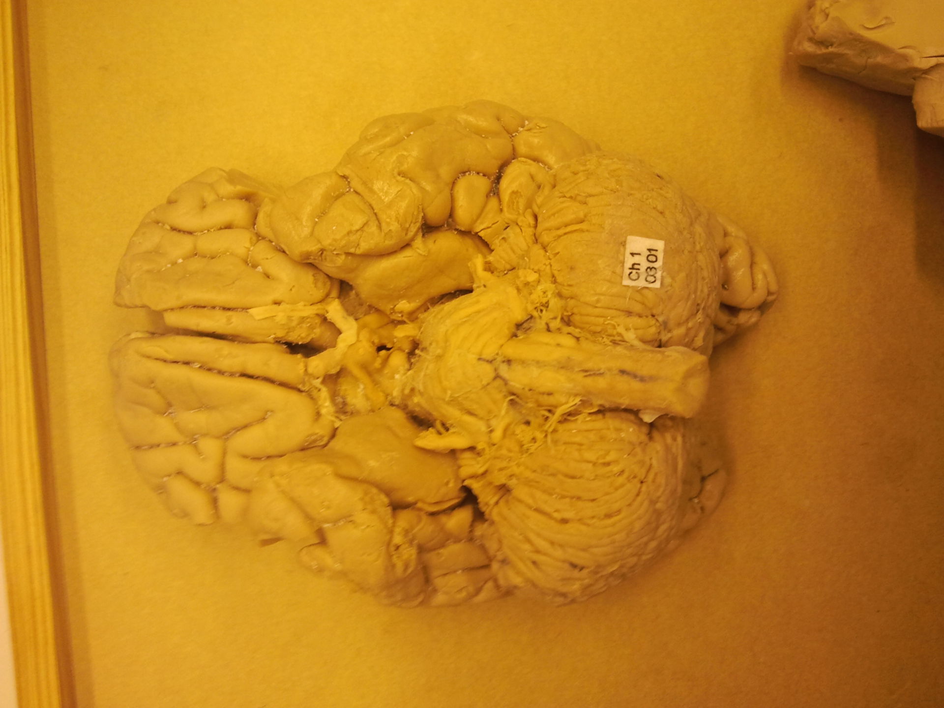 Gehirn von kaudal