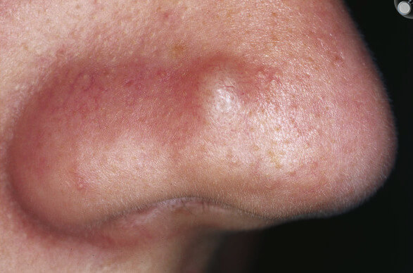 derm02_original.jpg