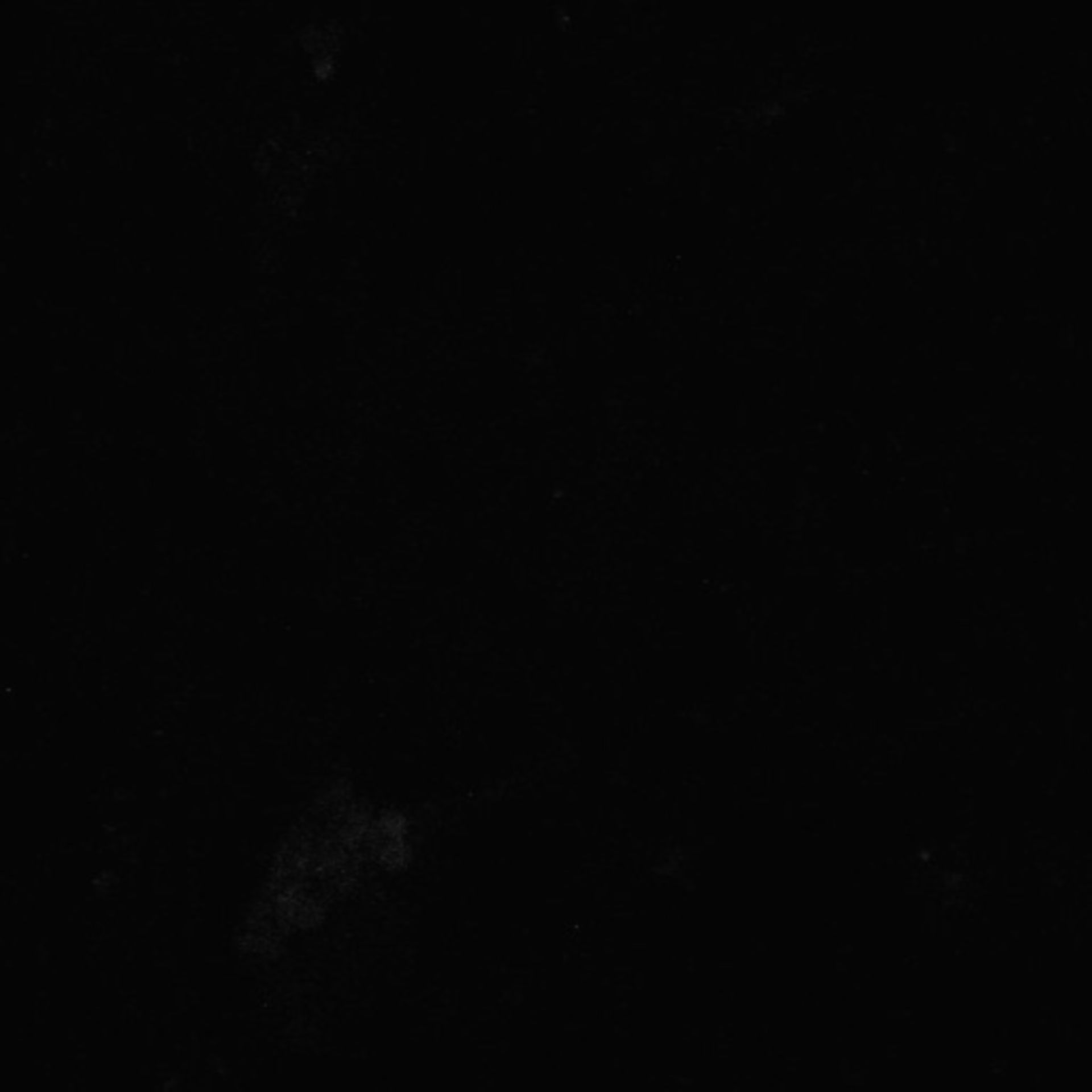 Xenopus laevis (Axon) - CIL:36980