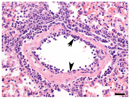 csm_004_pressestelle_endothel_91a15546ae_original.jpg