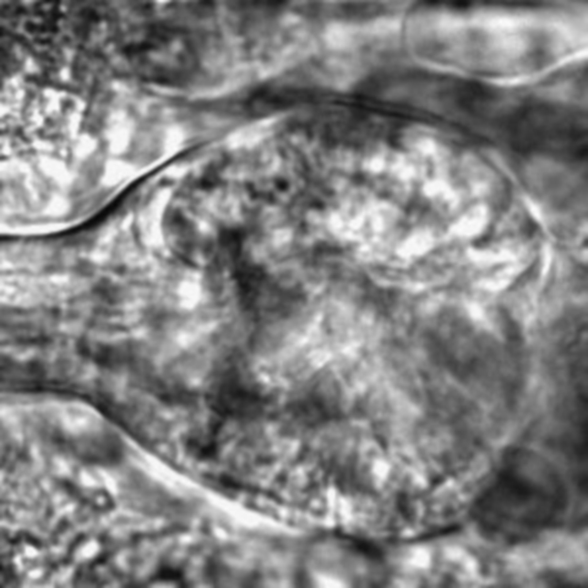 Caenorhabditis elegans - CIL:2717