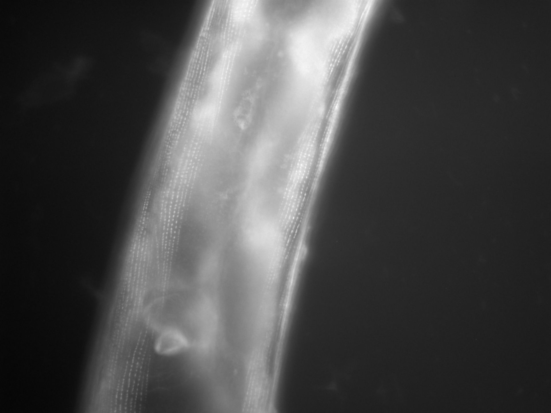 Caenorhabditis elegans (Actin filament) - CIL:1129