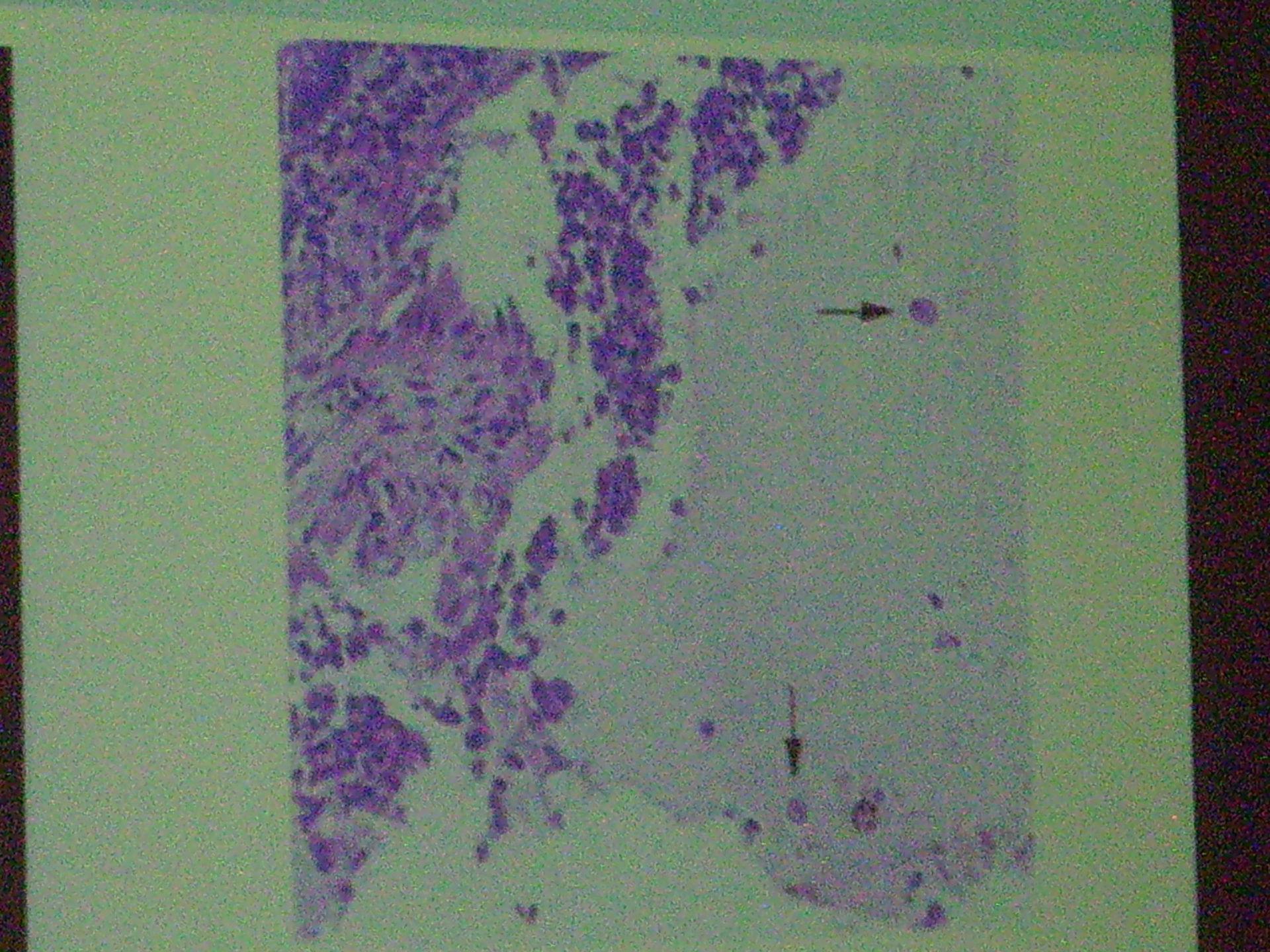 Corso di medicina tropicale a Lipsia