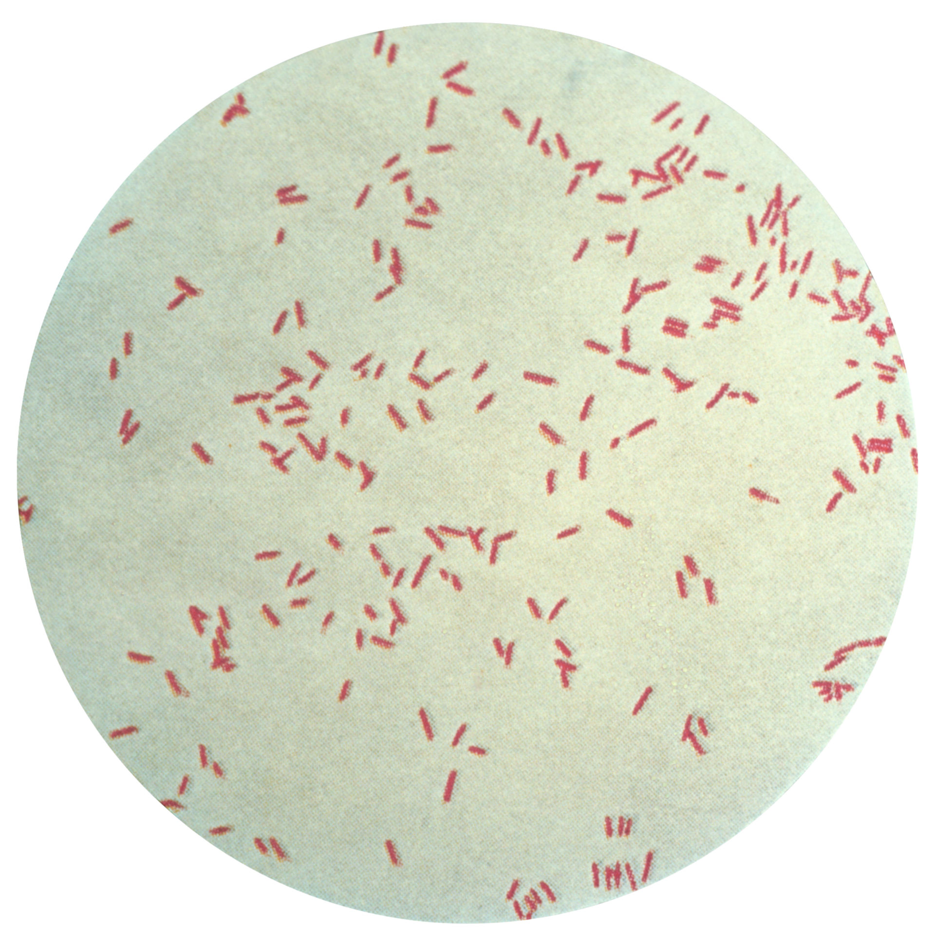 Синегнойная палочка под микроскопом. Pseudomonas Fluorescens колония. Бактерии рода Pseudomonas. Синегнойная палочка псевдомоноз.