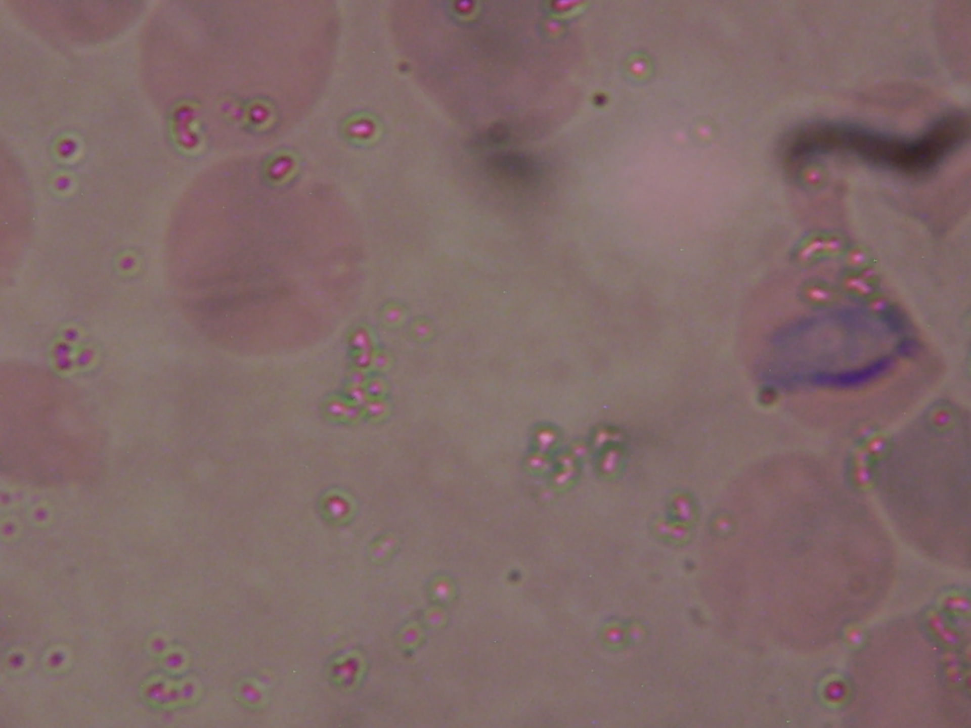 Plasmodium a forma di nastro