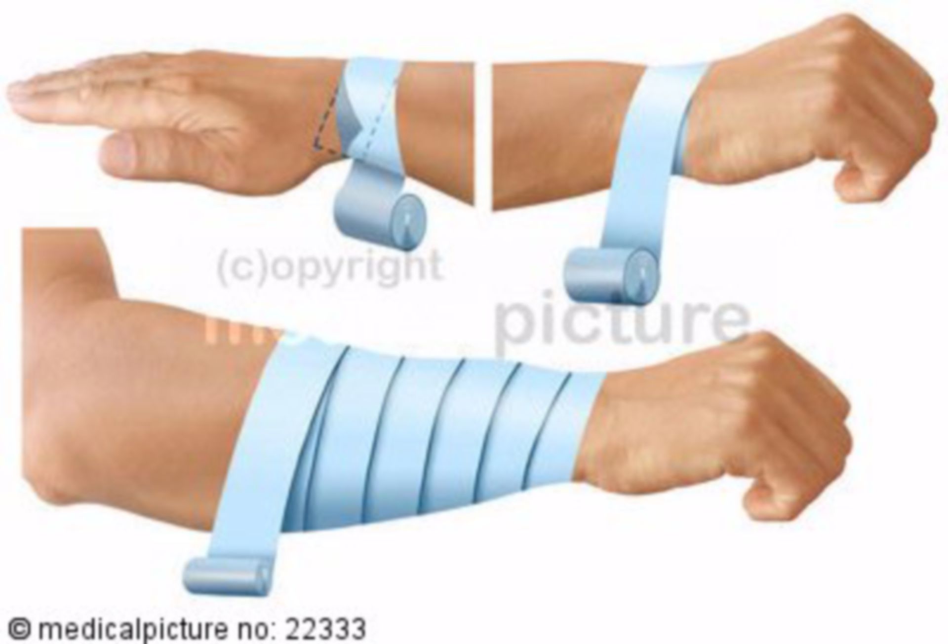  Notverband 
