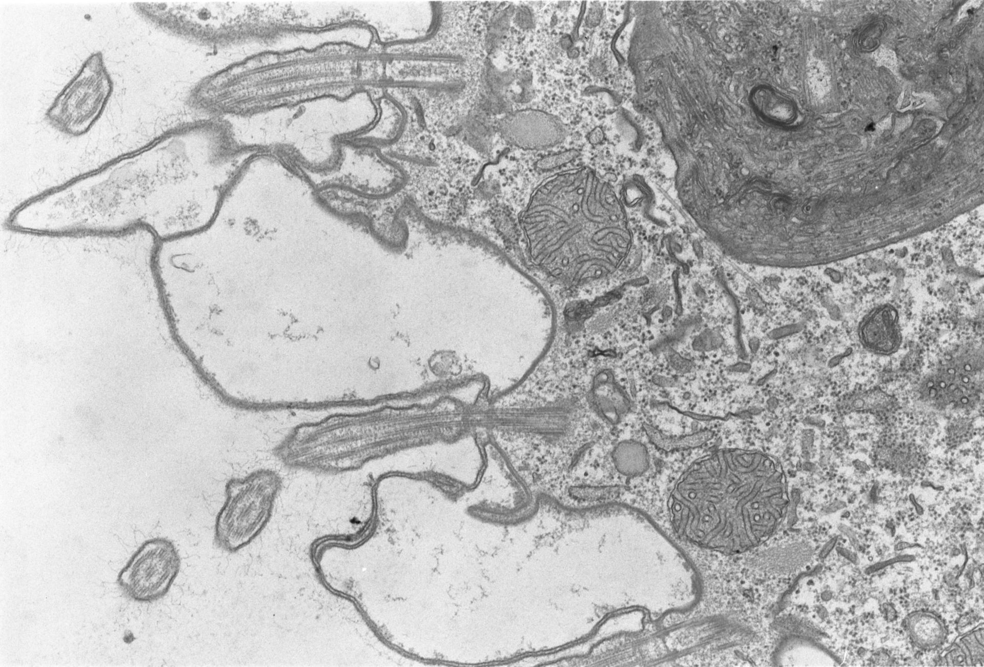 Coleps hirtus (Food vacuole) - CIL:2870