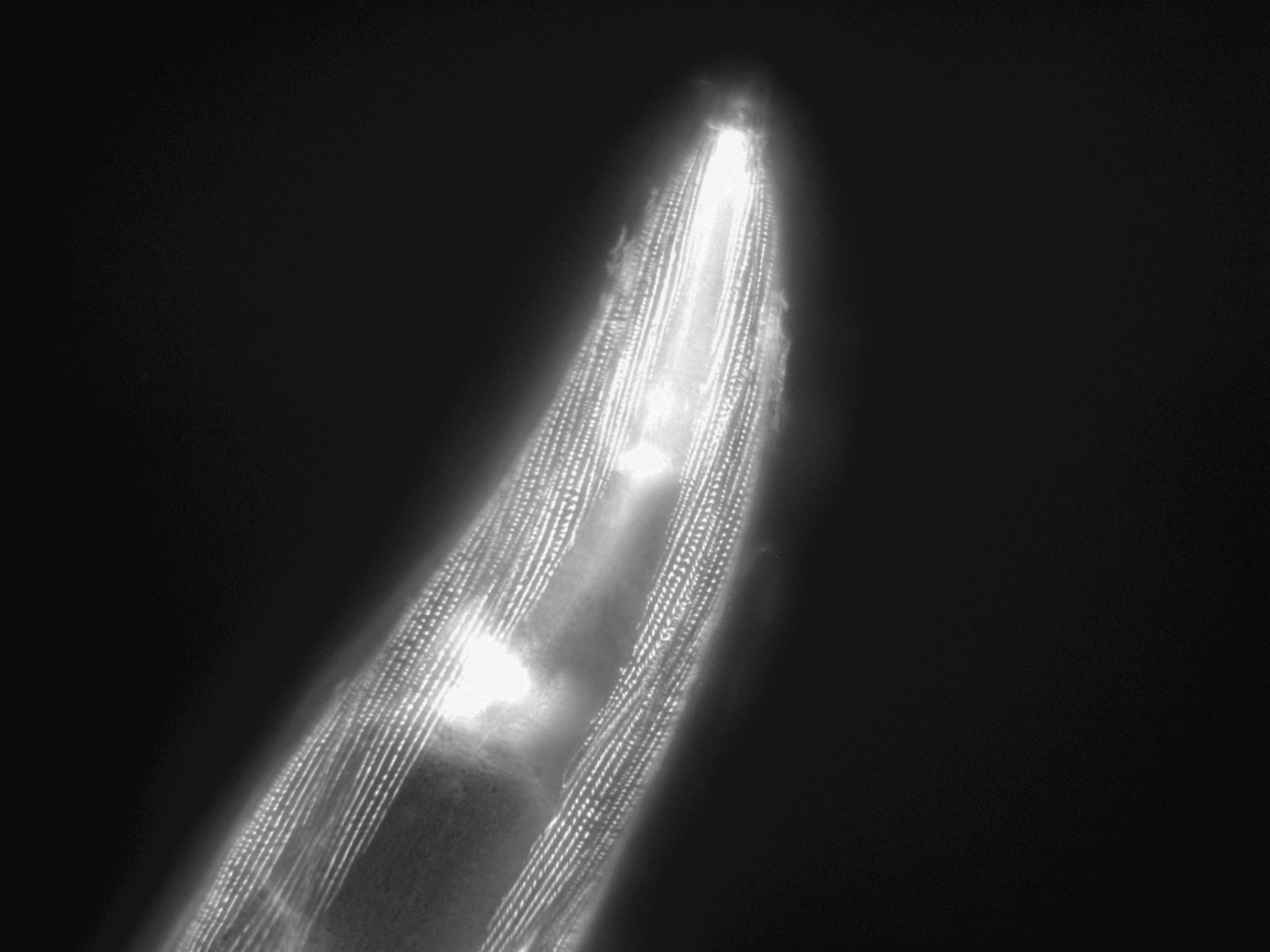 Caenorhabditis elegans (Actin filament) - CIL:1177