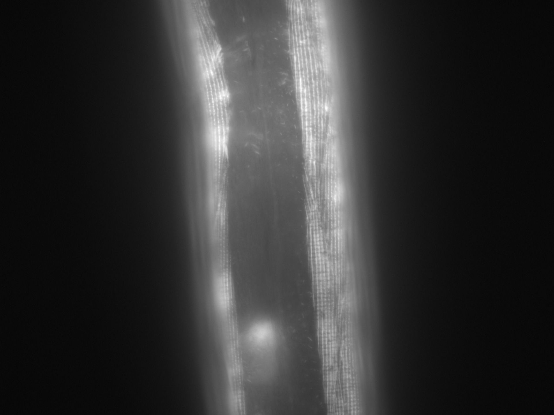 Caenorhabditis elegans (Actin filament) - CIL:1006