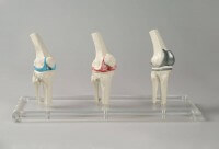 Erler-Zimmer Knie-Implantat Modell Erler-Zimmer Knie-Implantat Modell