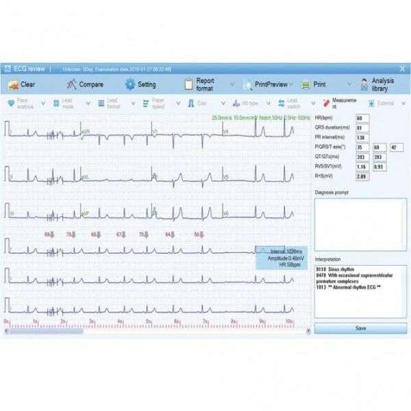 EKG-Software EKG-Software