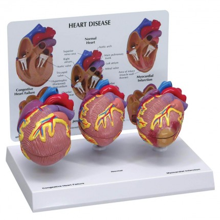 Set de 3 cœurs miniatures