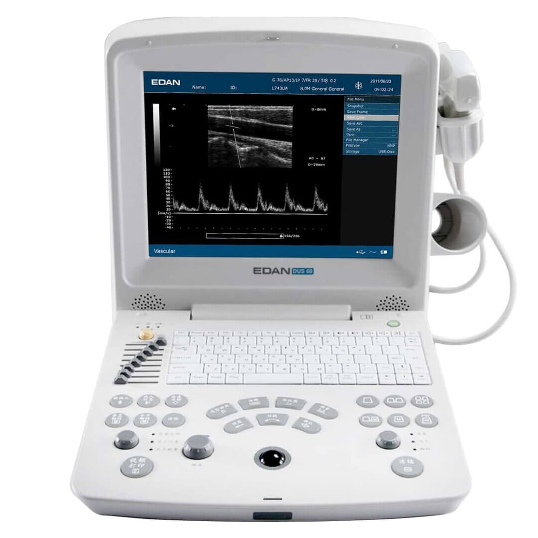 DUS 60 Ultraschallgerät