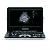 VINNO Draagbare ultrasound scanner Vinno A5