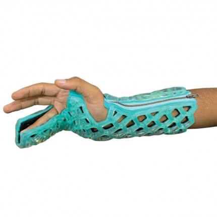 FlexiOH Immobilizer Orthosis - Ulnar Gutter