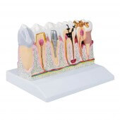 Erler-Zimmer Dentalmodell