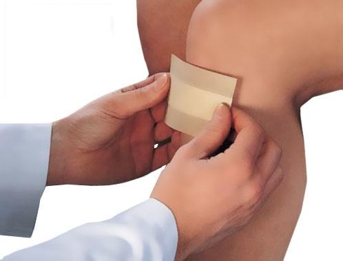 Curaplast Quick Wound Dressing Curaplast Quick Wound Dressing