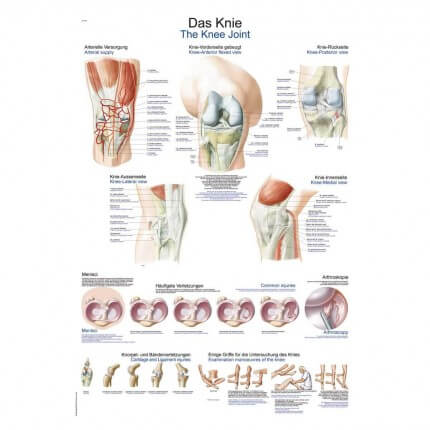 Lehrtafel – Das Knie