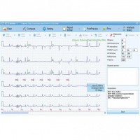 Biocare ECG-1000 EKG-Datenmanagement-Software Biocare ECG-1000 EKG-Datenmanagement-Software