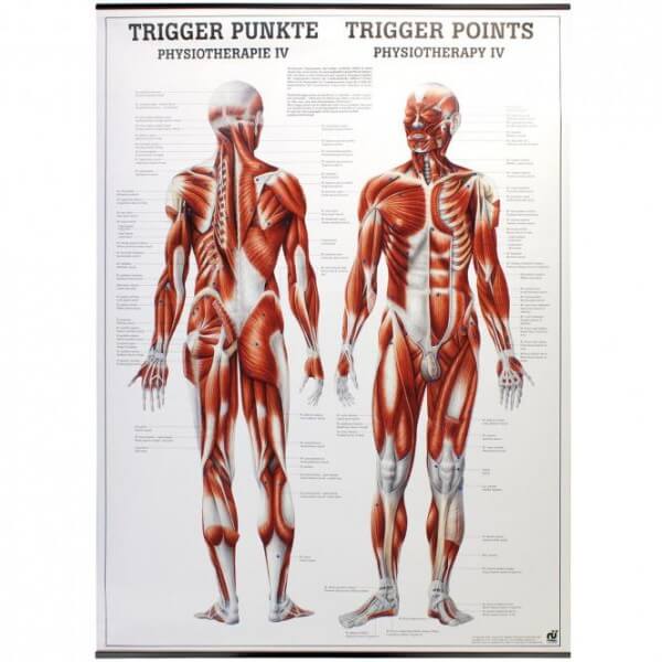 Lehrtafel - Trigger Punkte Lehrtafel - Trigger Punkte