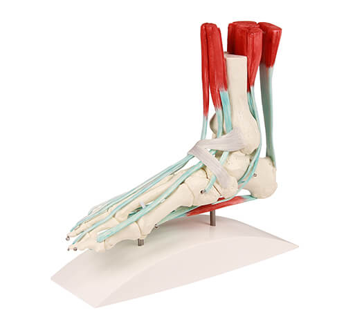 Frohse-Arkade - DocCheck Flexikon