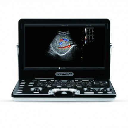 Draagbare ultrasound scanner Vinno A5