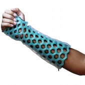 OrthoHeal FlexiOH Immobilizer Orthese – Short Arm